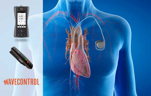 Active Implant Medical Devices Safety: EME Interferences, EMC Testing with Wavecontrol SMP3 Portable Monitoring Device
